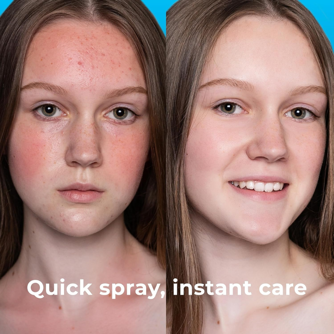 Hypochlorous Acid Spray